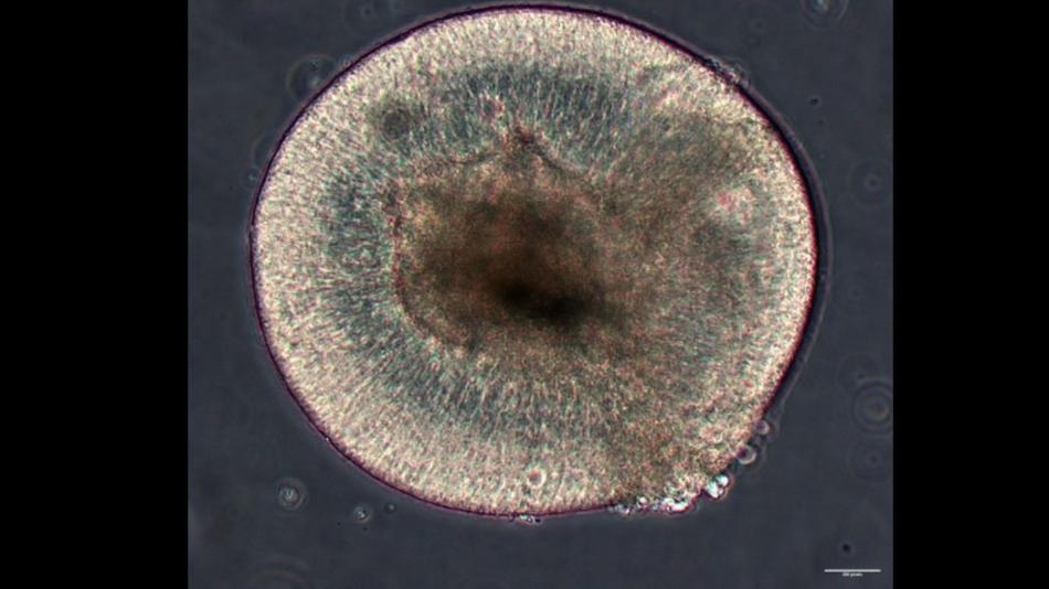 Organoid