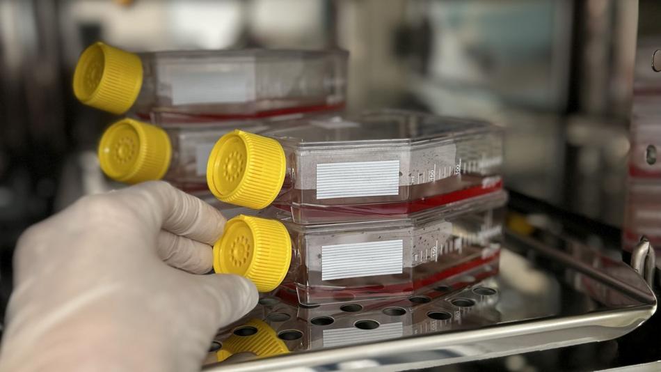 Leukämie-Therapie im Fokus