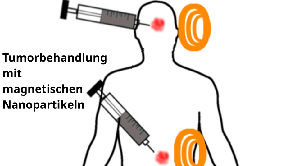 Darstellung zu Tumorbehandlung mit magnetischen Nanopartikeln