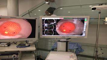Das am Stand verwendete System mit Endoskop, Video und Navigationssystem